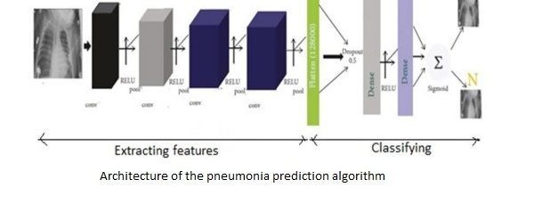 pneumonia model