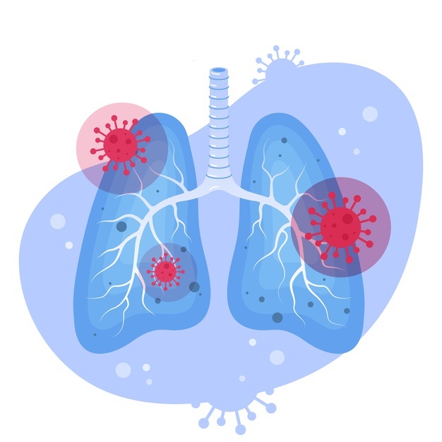 Pneumonia Detection